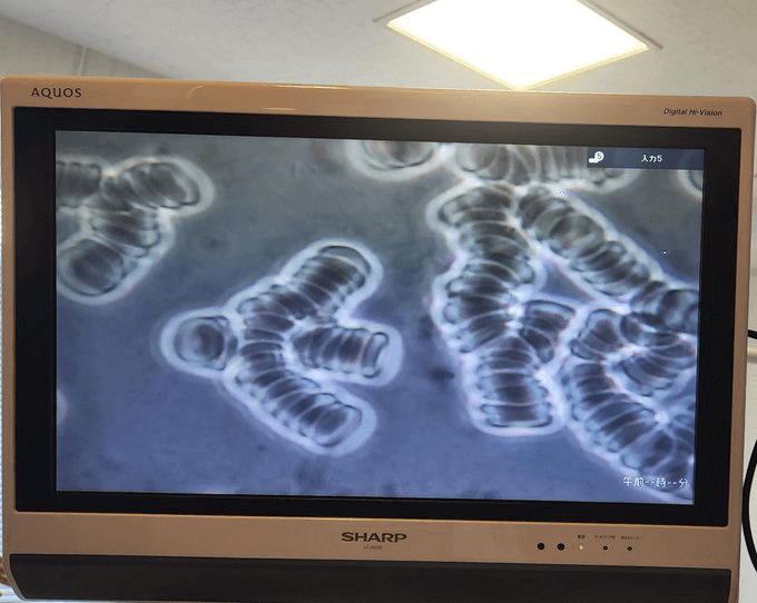 血液の数珠つなぎ